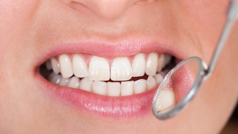 К чему приводят заболевания зубов